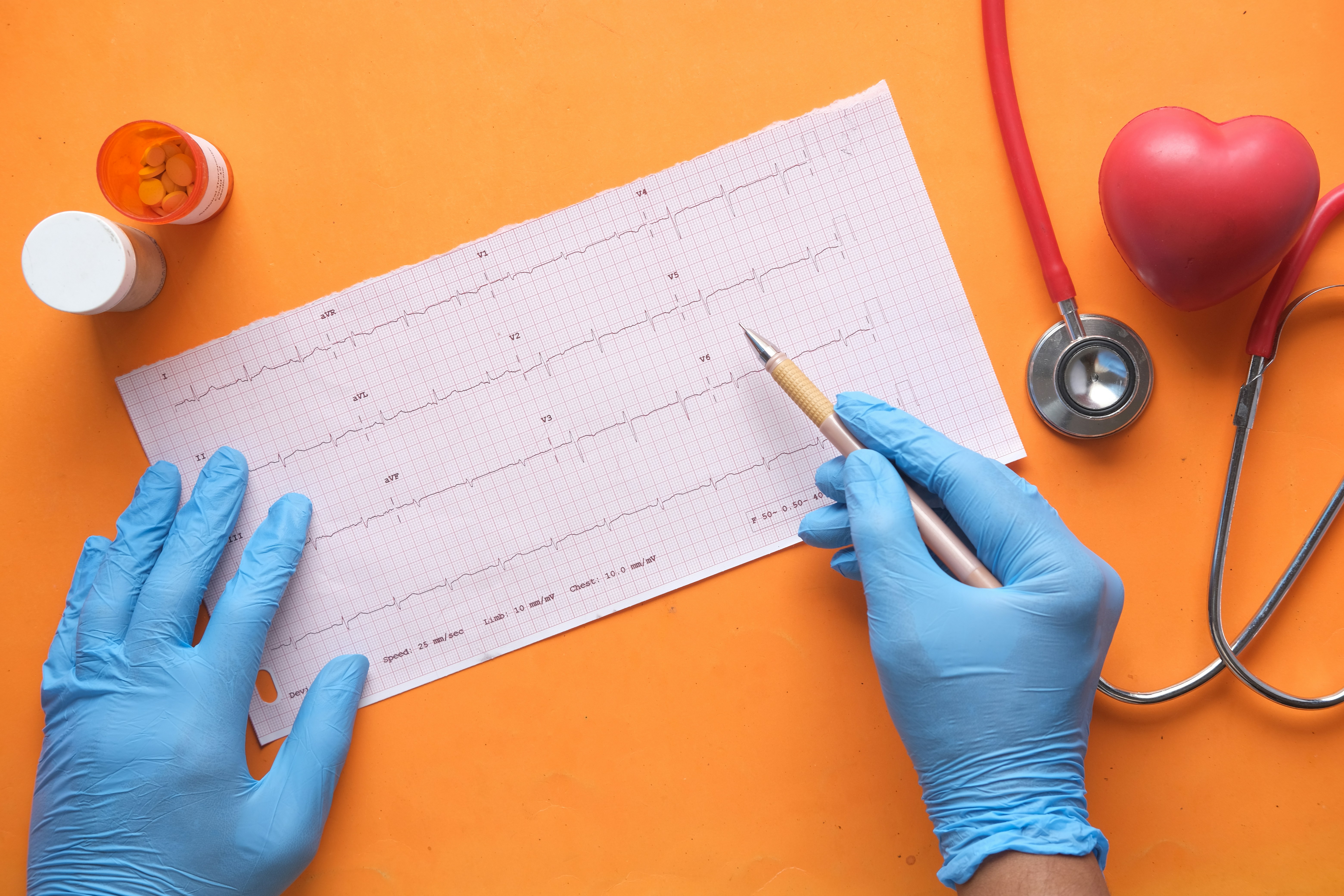 Comissão Europeia propõe rastreios cardiovasculares para todos e recomenda exames regulares a partir dos 35 anos