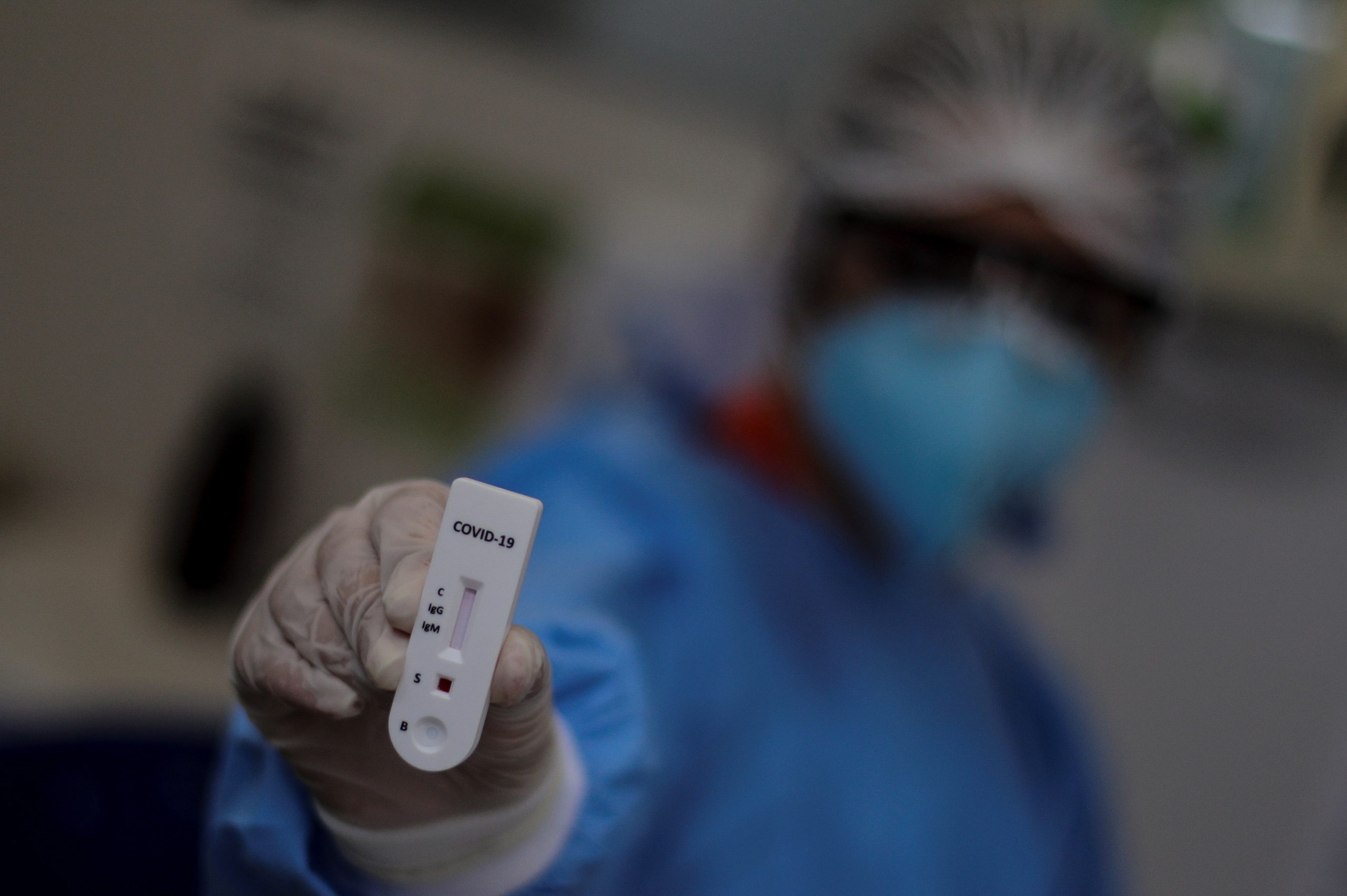 Covid-19: Oeiras investe 100.000 euros para desenvolvimento de testes serológicos
