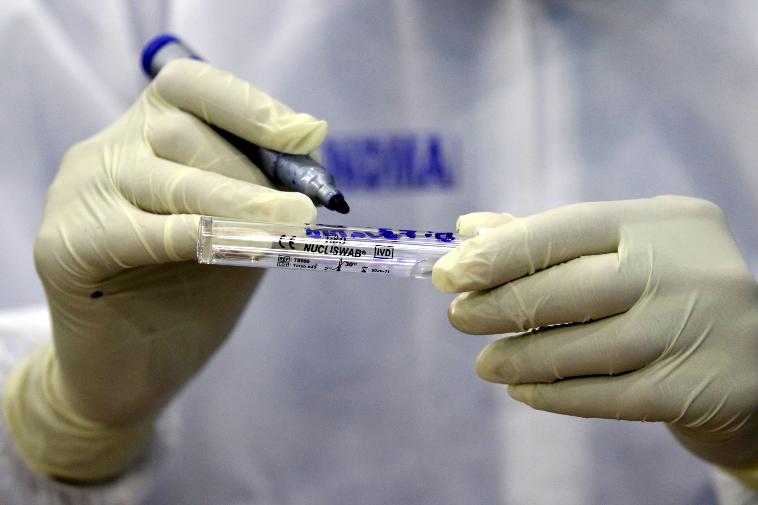 Covid-19: Farmacêutica Lilly lança primeiro estudo de tratamento com anticorpos