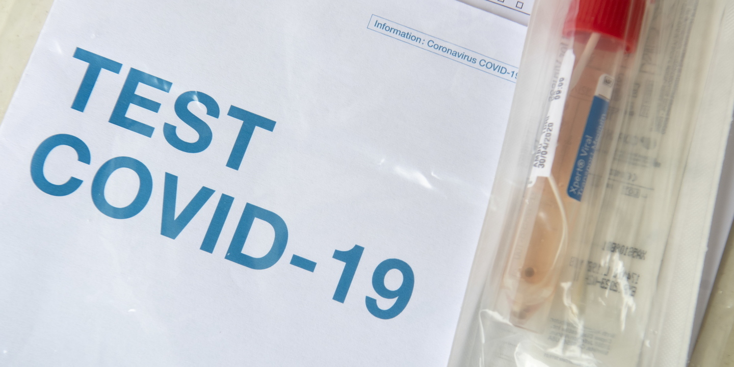 Covid-19: Testes rápidos devem ser aplicados em surtos em escolas ou lares