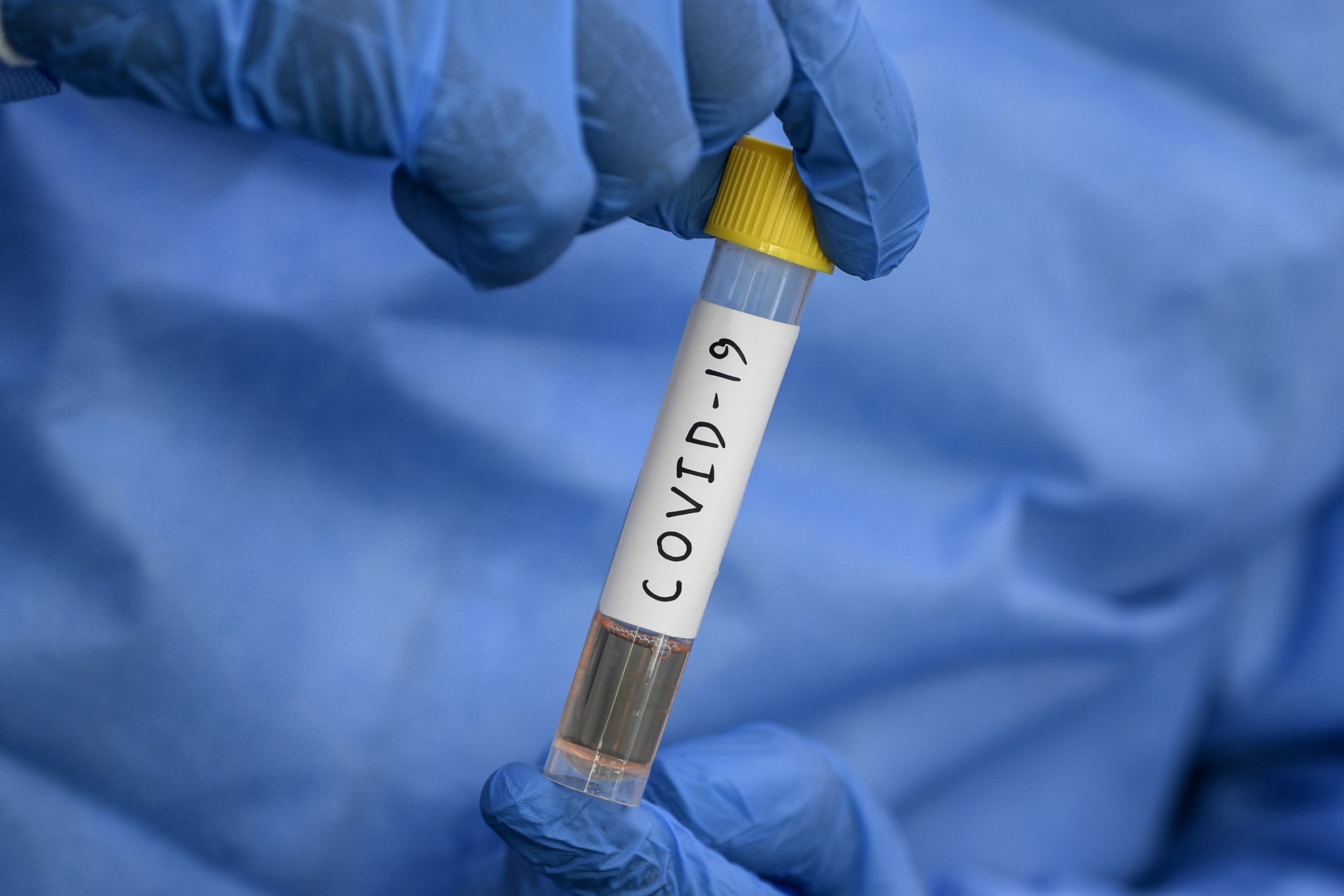 Covid-19: Detetados 34 casos em empresa de transformação de carnes em Tomar