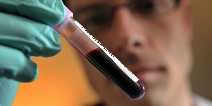 Sangue novo em corpos velhos. Uma espécie de Drácula ou a fonte da juventude?