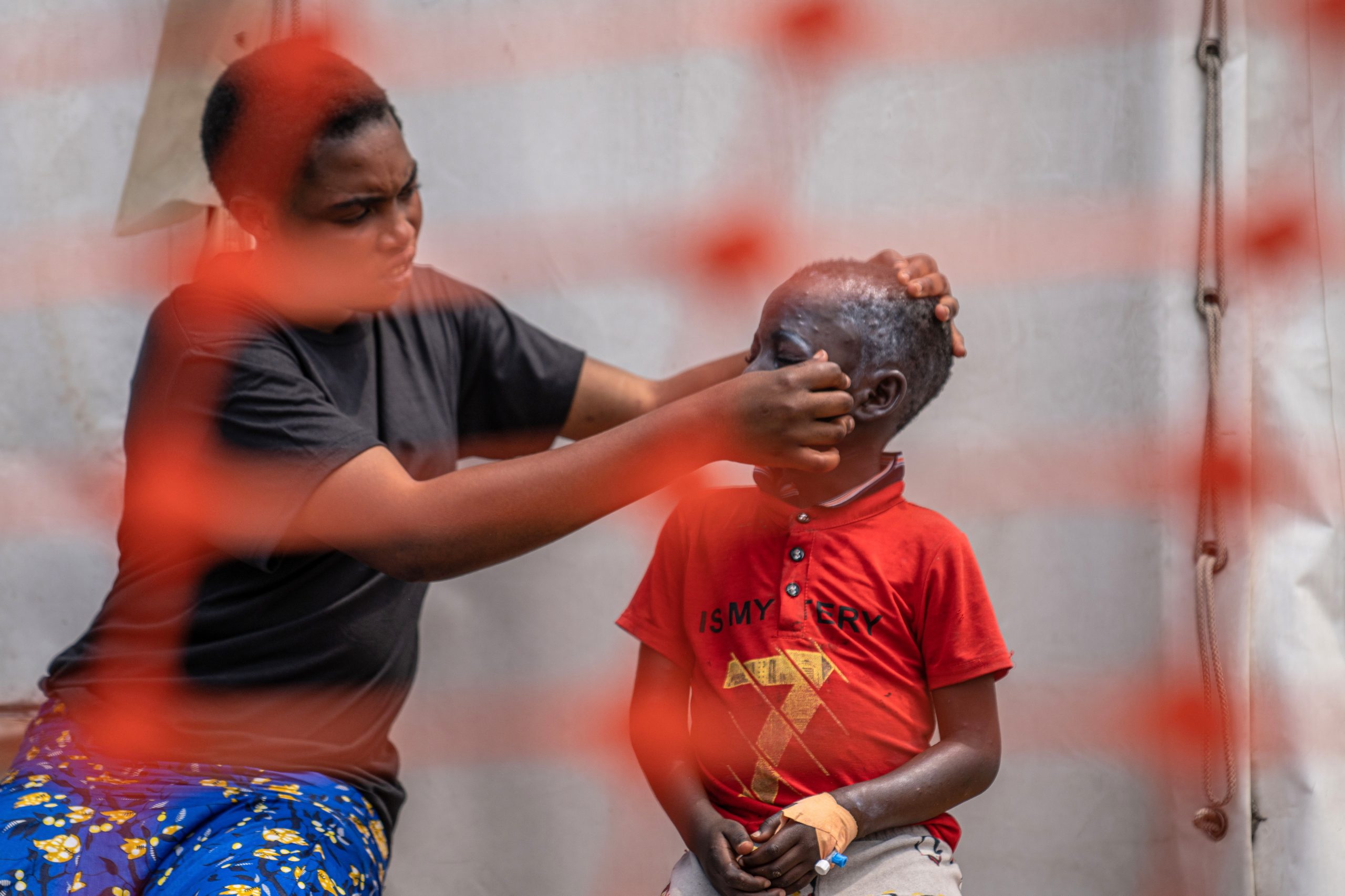 OIM pede 16,5 milhões de euros para conter surto de ‘Mpox’ na África oriental e austral