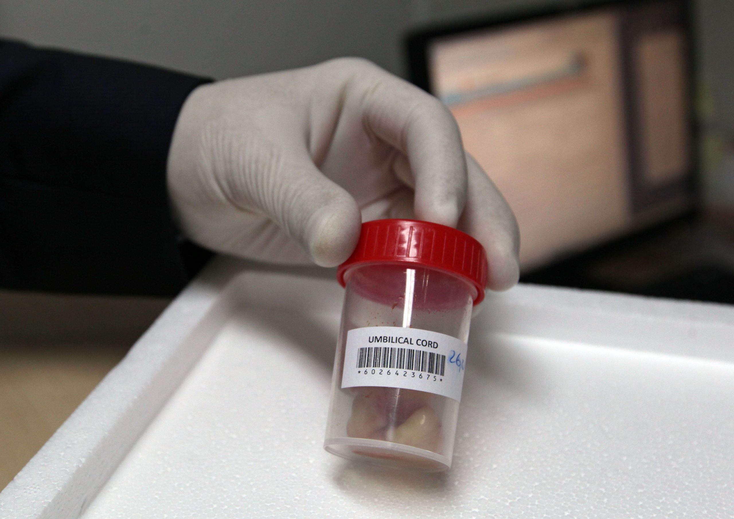 Dona da Crioestaminal compra ativos da Cytothera e notifica Concorrência