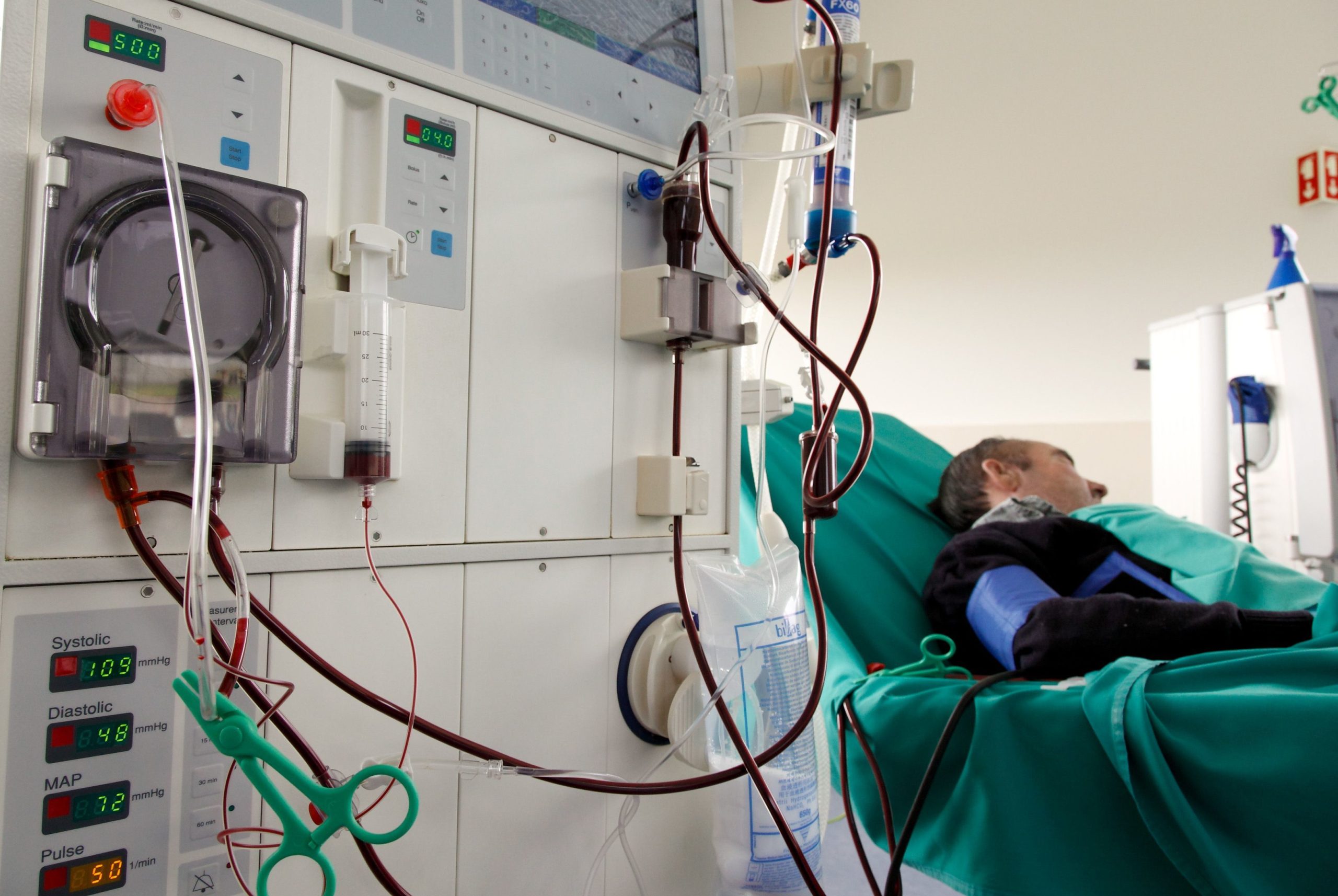 SNS. Uma simples alteração no sistema informático pode adiar a diálise e detetar a doença renal crónica mais cedo