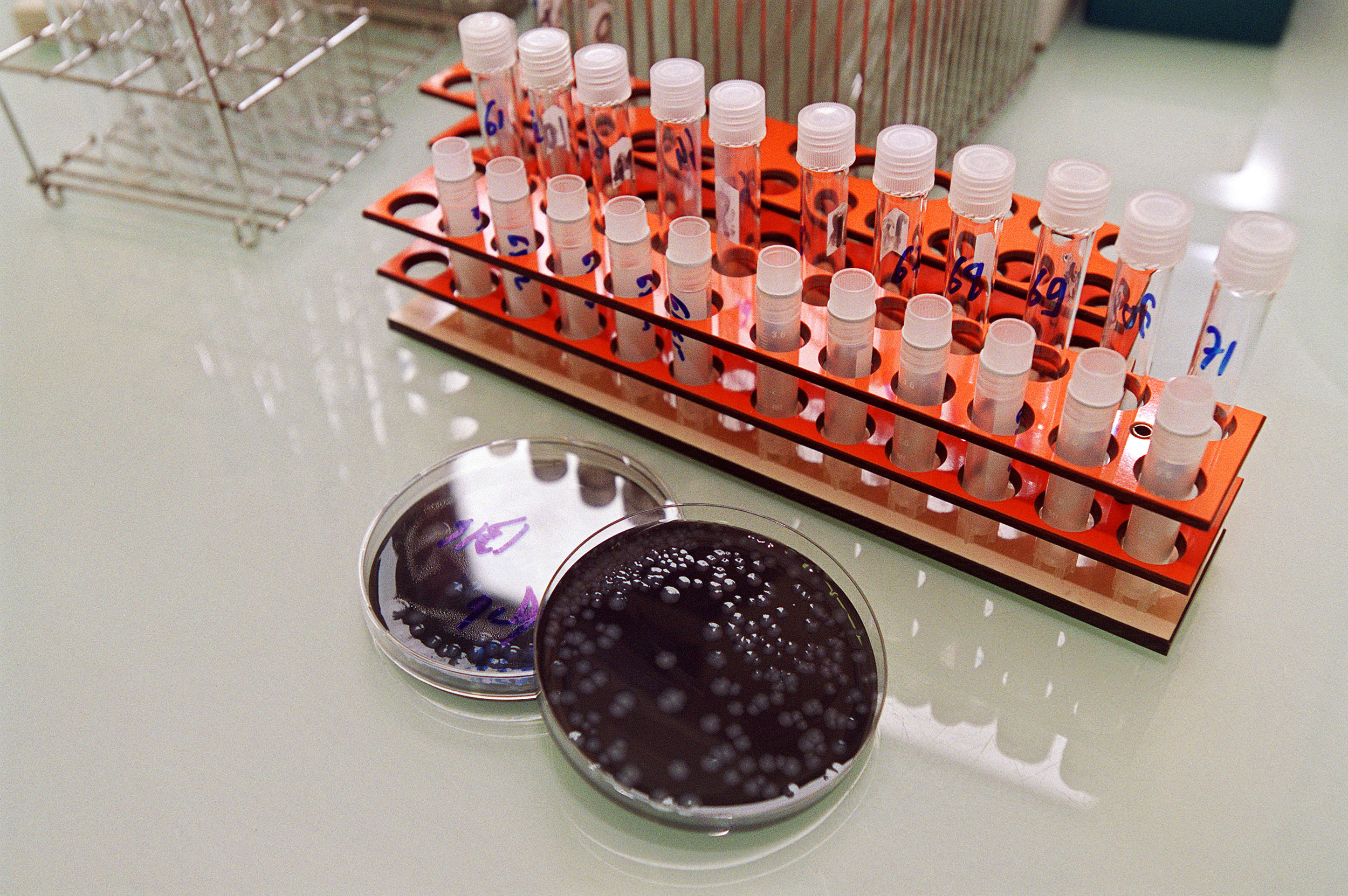Legionella: Hospital Cuf Descobertas está a contactar 800 doentes para despiste