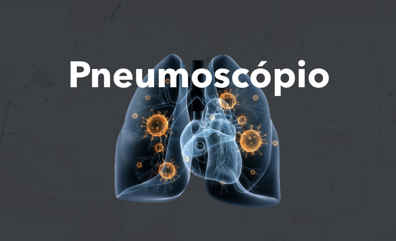 Portugal tem uma nova ferramenta para mapear internamentos e mortes por pneumonia e meningite
