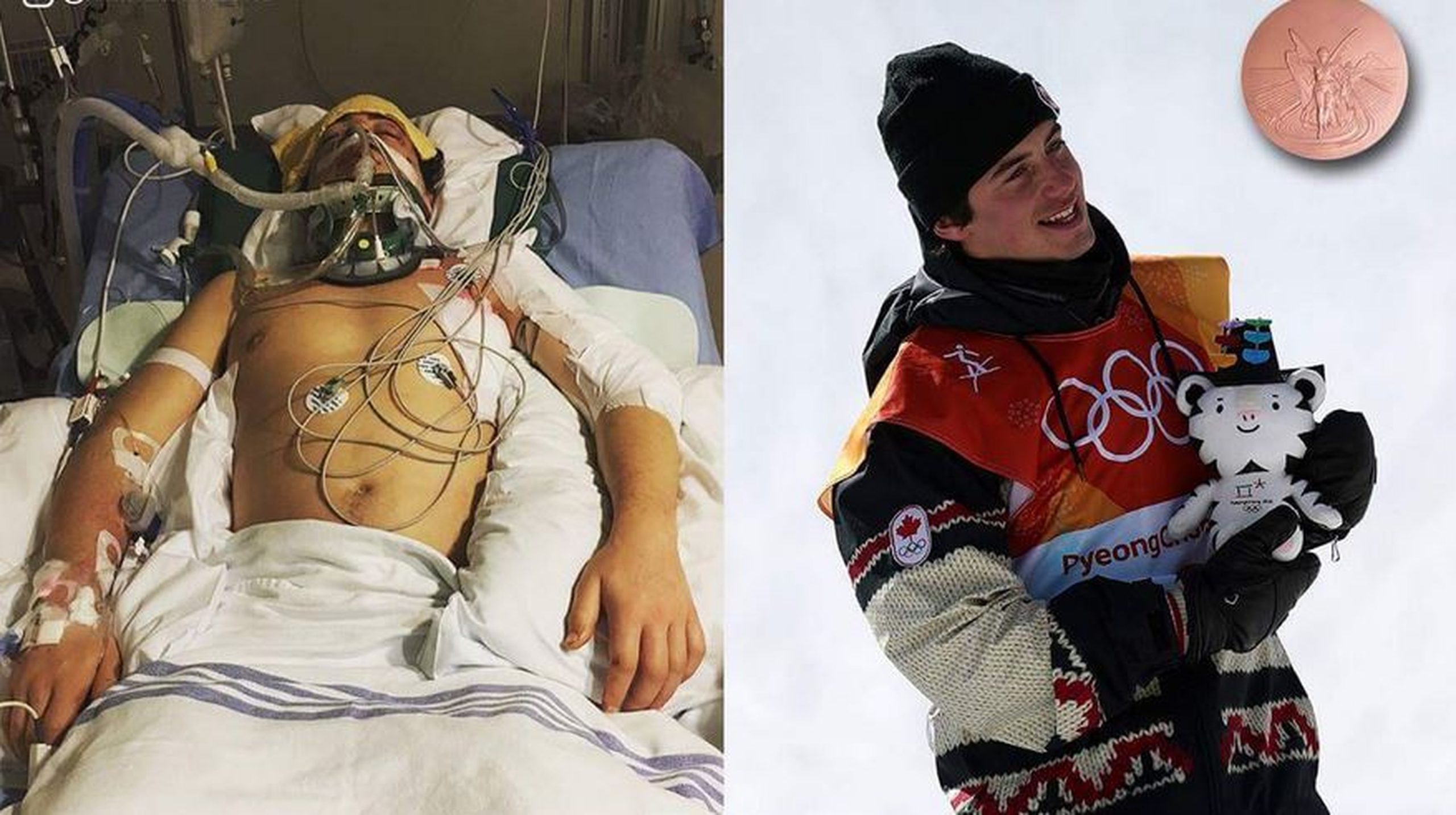 Do coma ao pódio em PyeongChang, a história de Mark McMorris