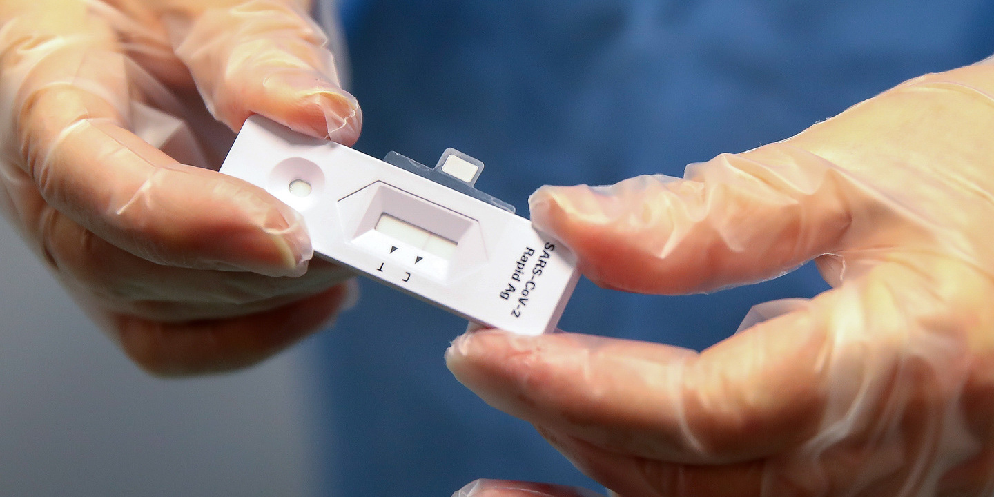 Covid-19: Autotestes passam a integrar Estratégia Nacional de Testes