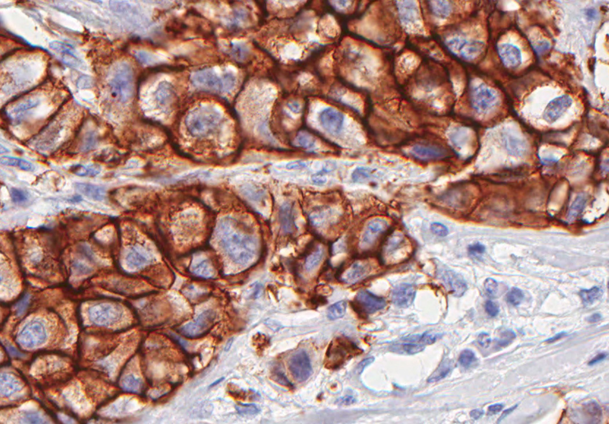 Tumor diminui quando combinada radioterapia e nanopartículas de origem animal