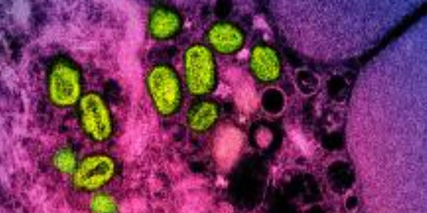 Mpox: Diretora do ECDC diz que vírus “não é o próximo covid-19”