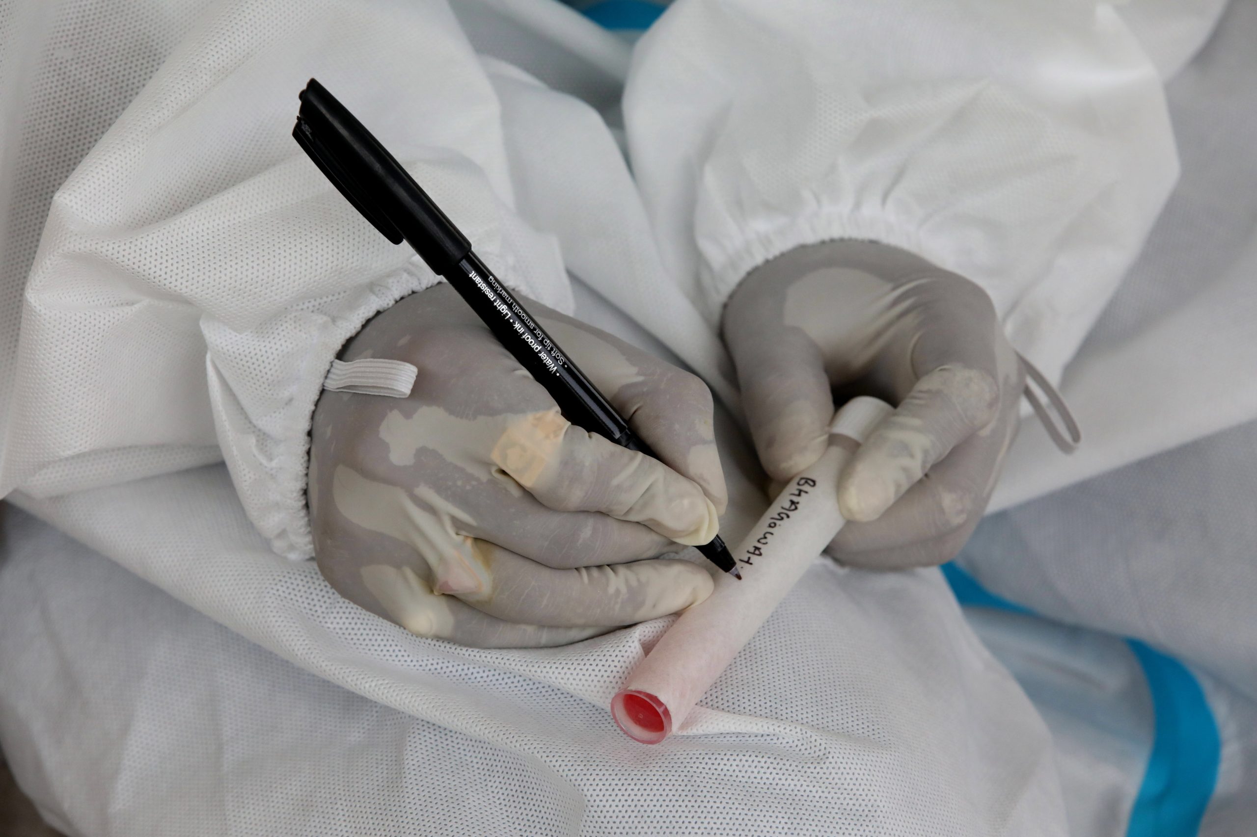 Covid-19: Testes rápidos vão ajudar África a ultrapassar “enormes necessidades”