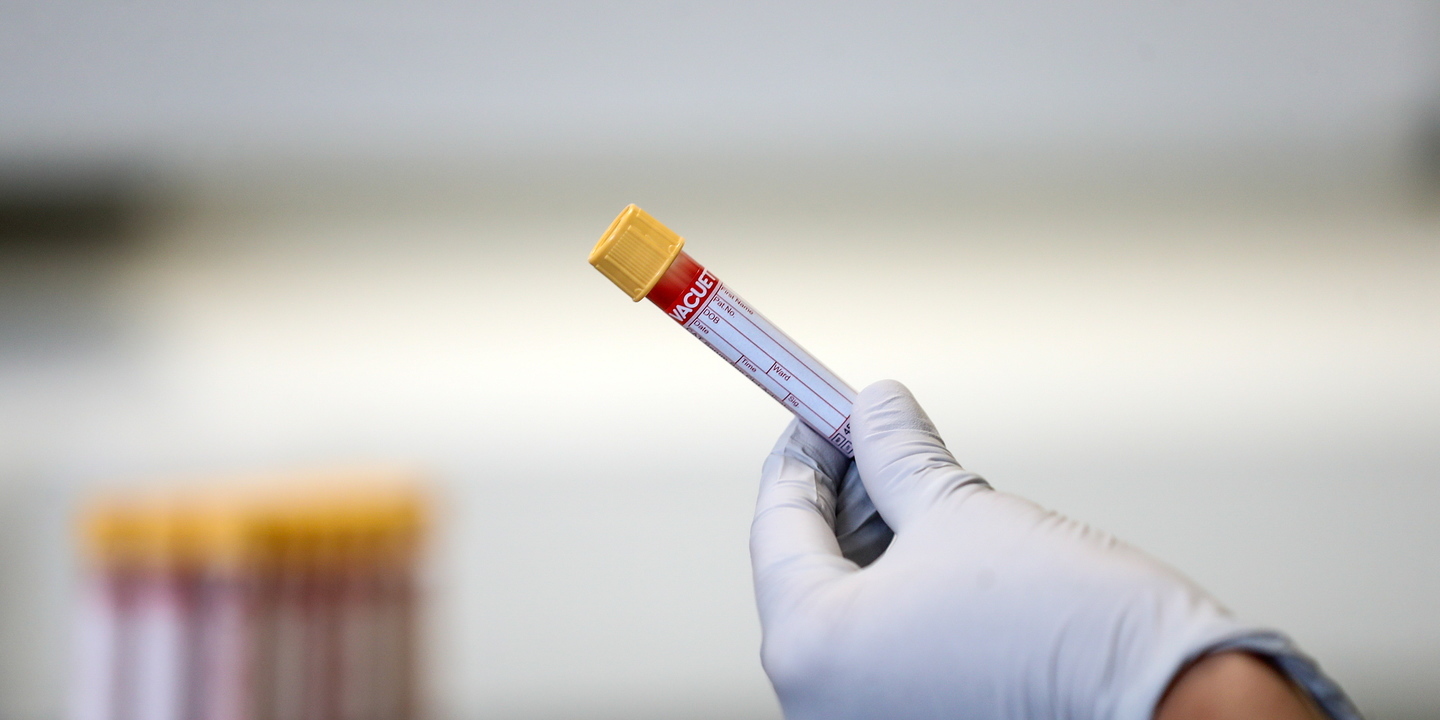 Covid-19: Bruxelas emite recomendações sobre uso de testes rápidos de antigénio
