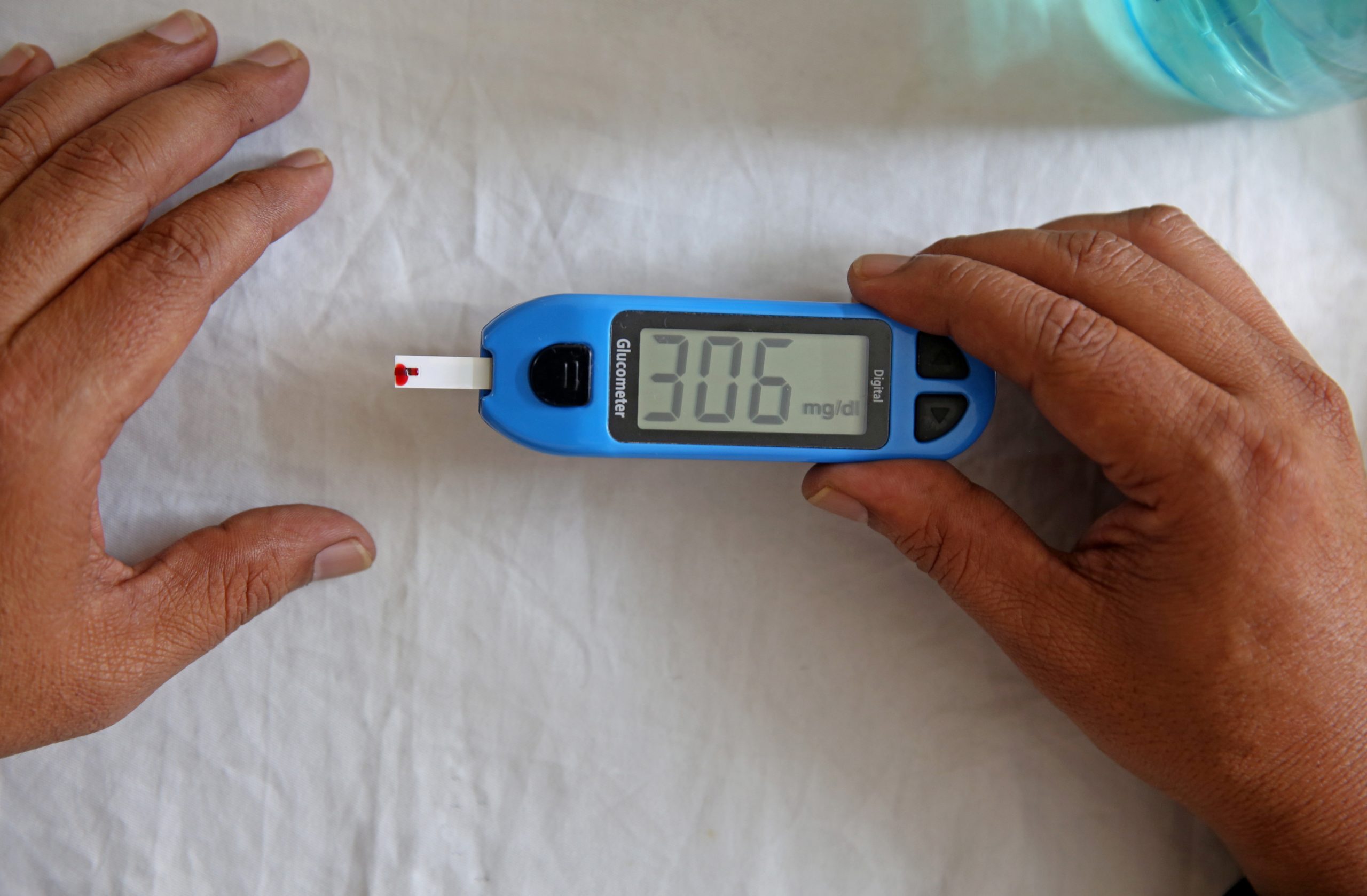 Disponibilizado novo sensor de glicémia por constrangimentos no abastecimento, informa Infarmed