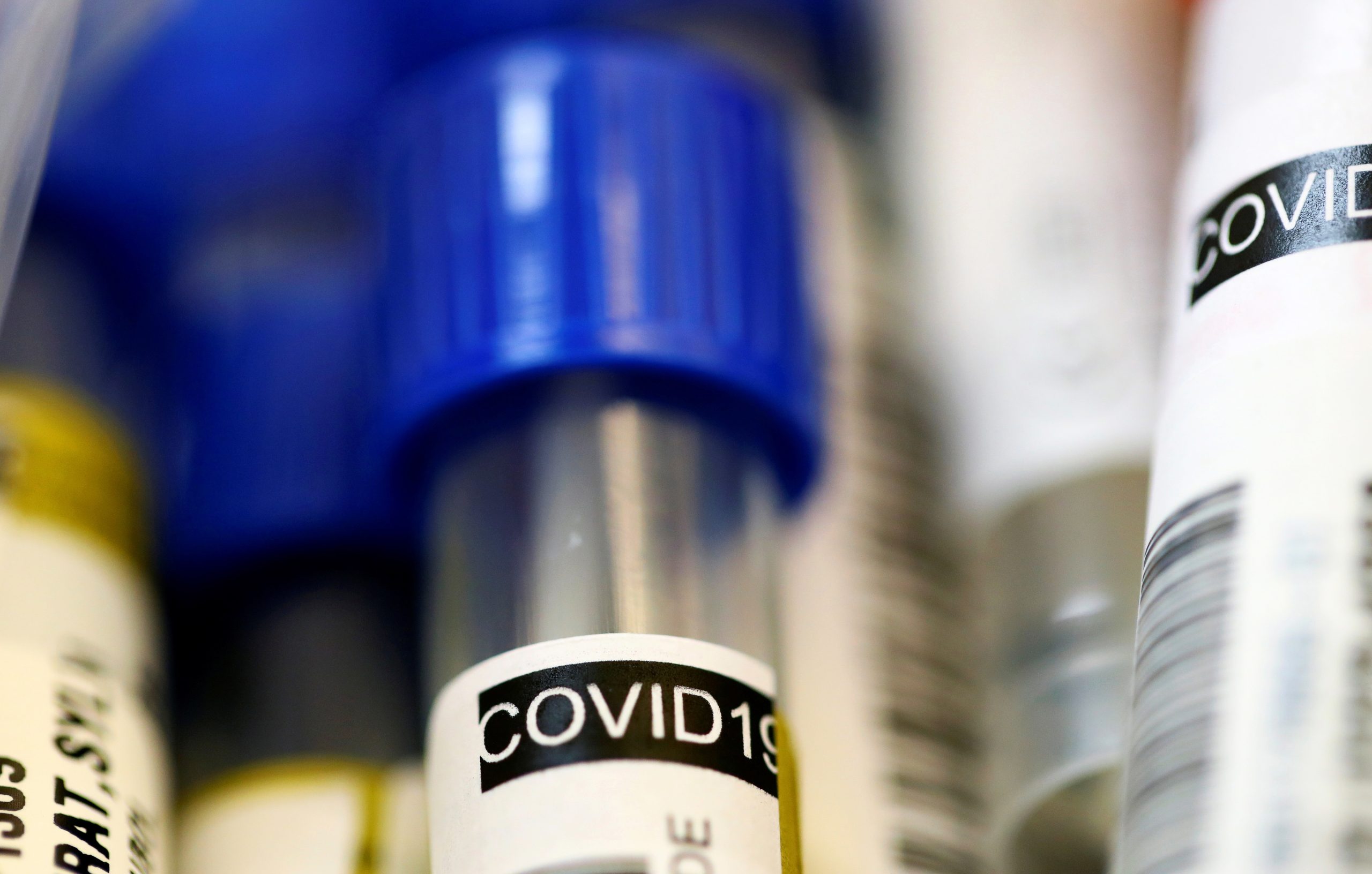 Surto em aldeia de Moura sobe para 31 casos de covid-19