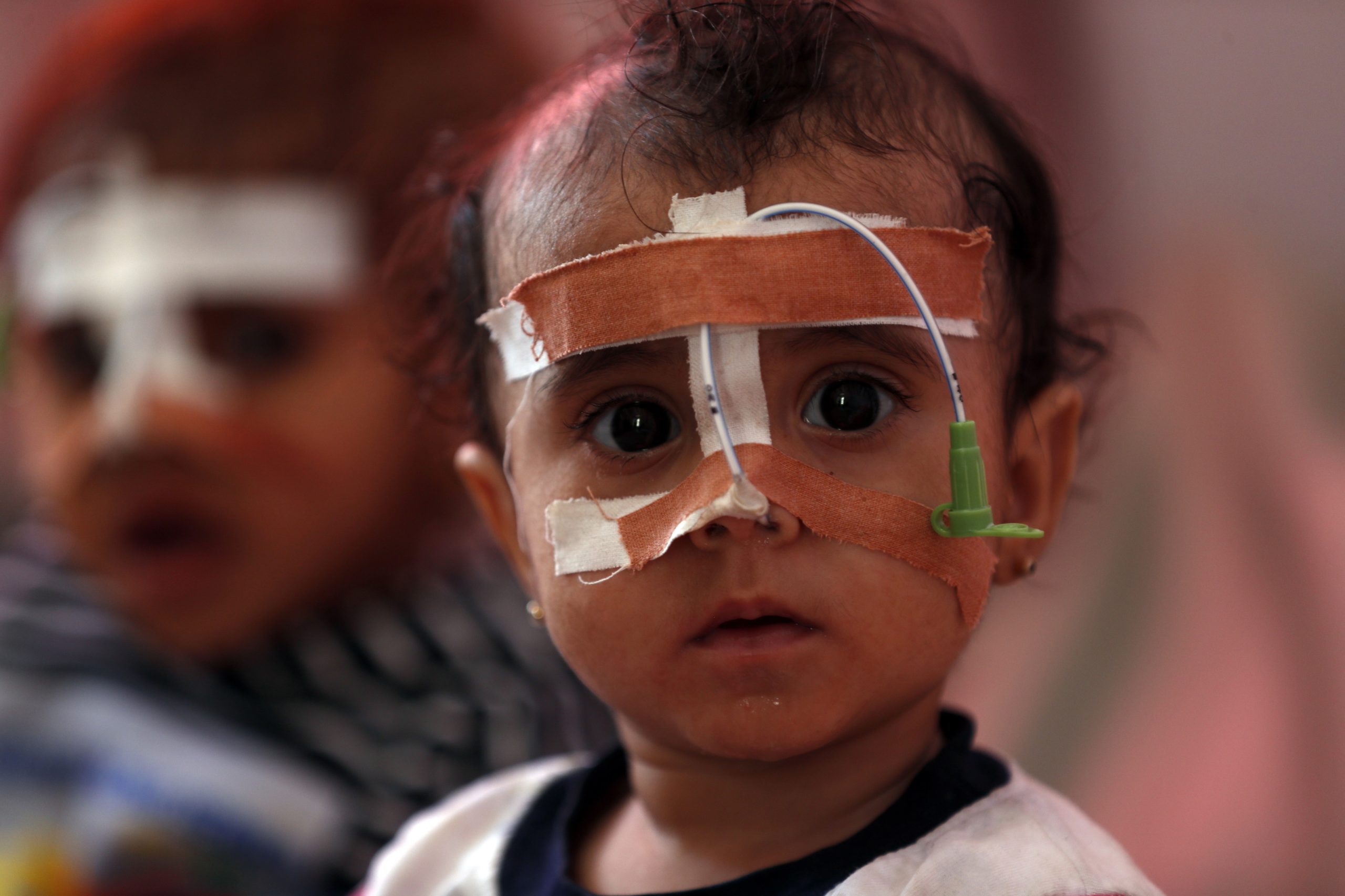 Iémen. Desnutrição infantil sem precedente desde o início da guerra em 2014