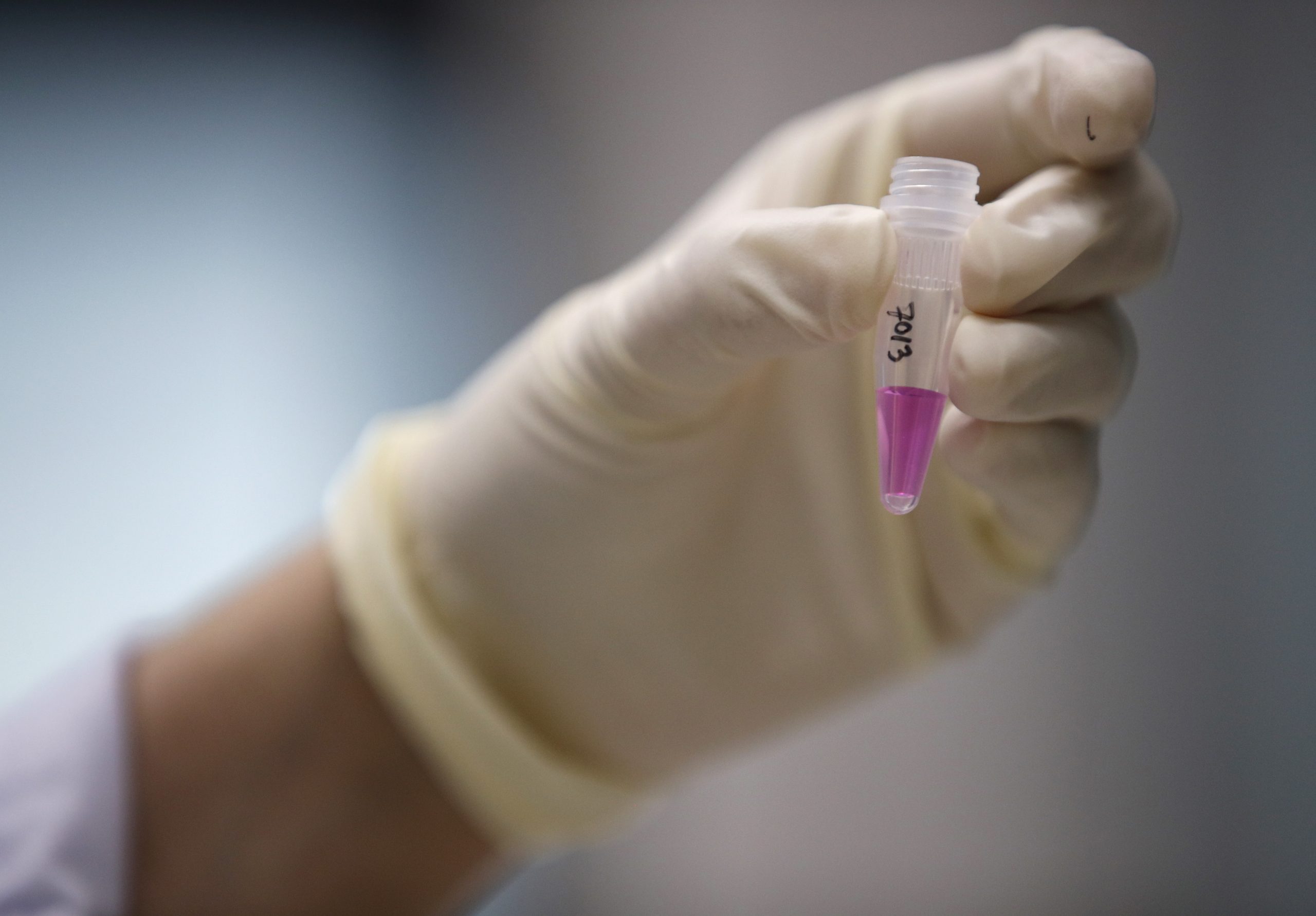 Identificados três surtos de mpox em Portugal desde junho de 2022