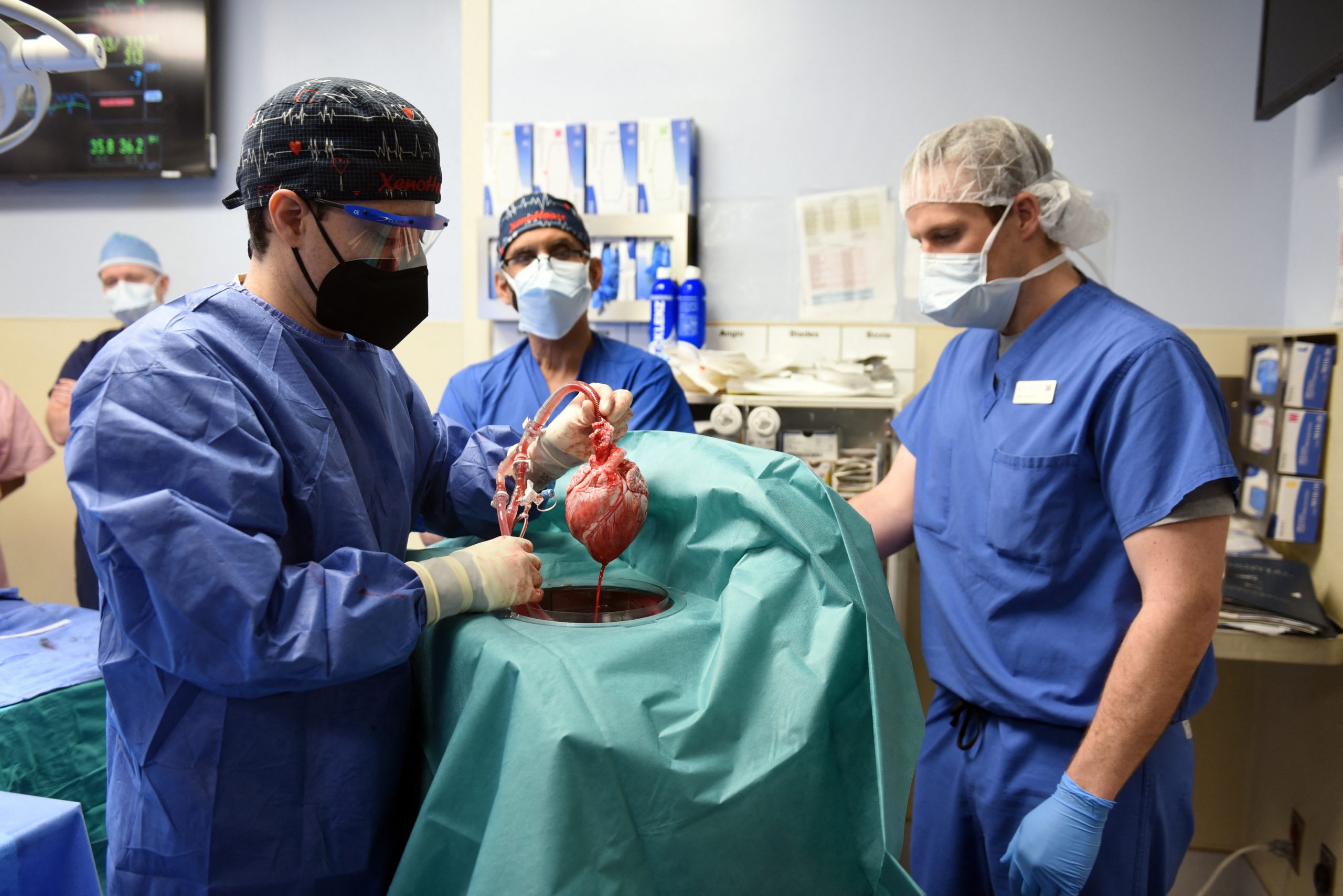 Realizou-se nos EUA o segundo transplante de coração de porco em humanos