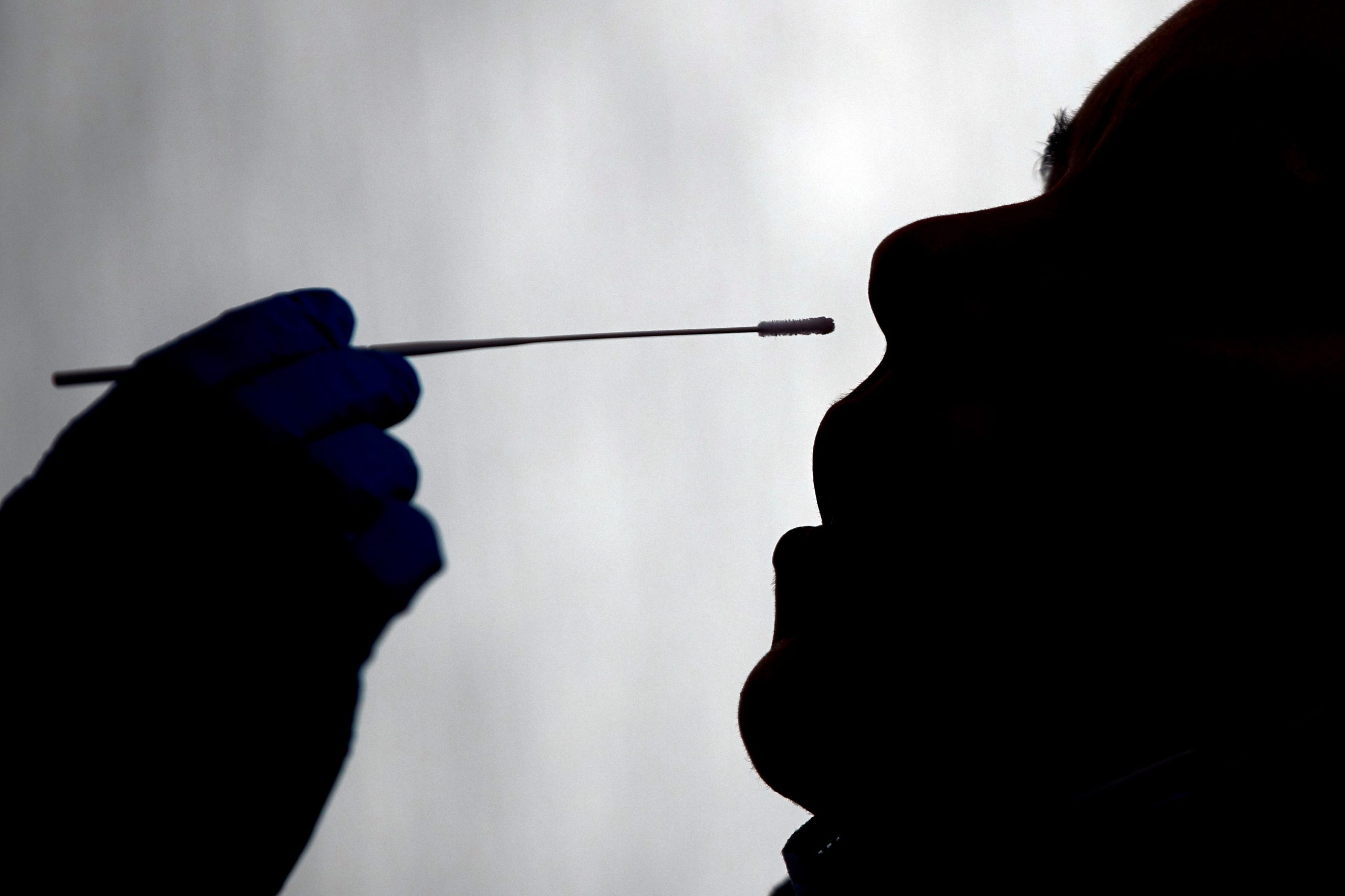 Testes com falsos positivos podem dever-se a contaminação da amostra
