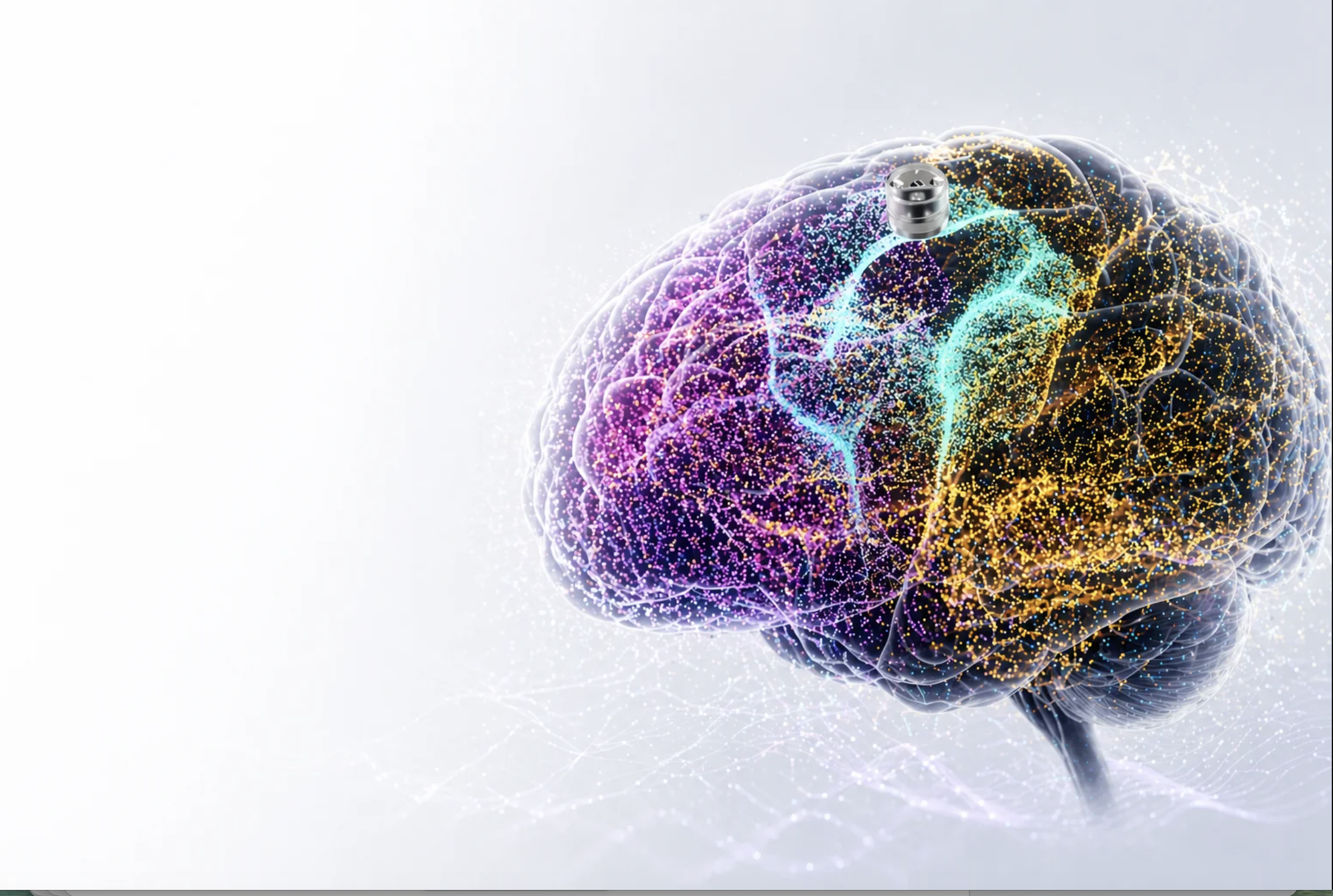 O implante cerebral que vai ser testado para combater a depressão