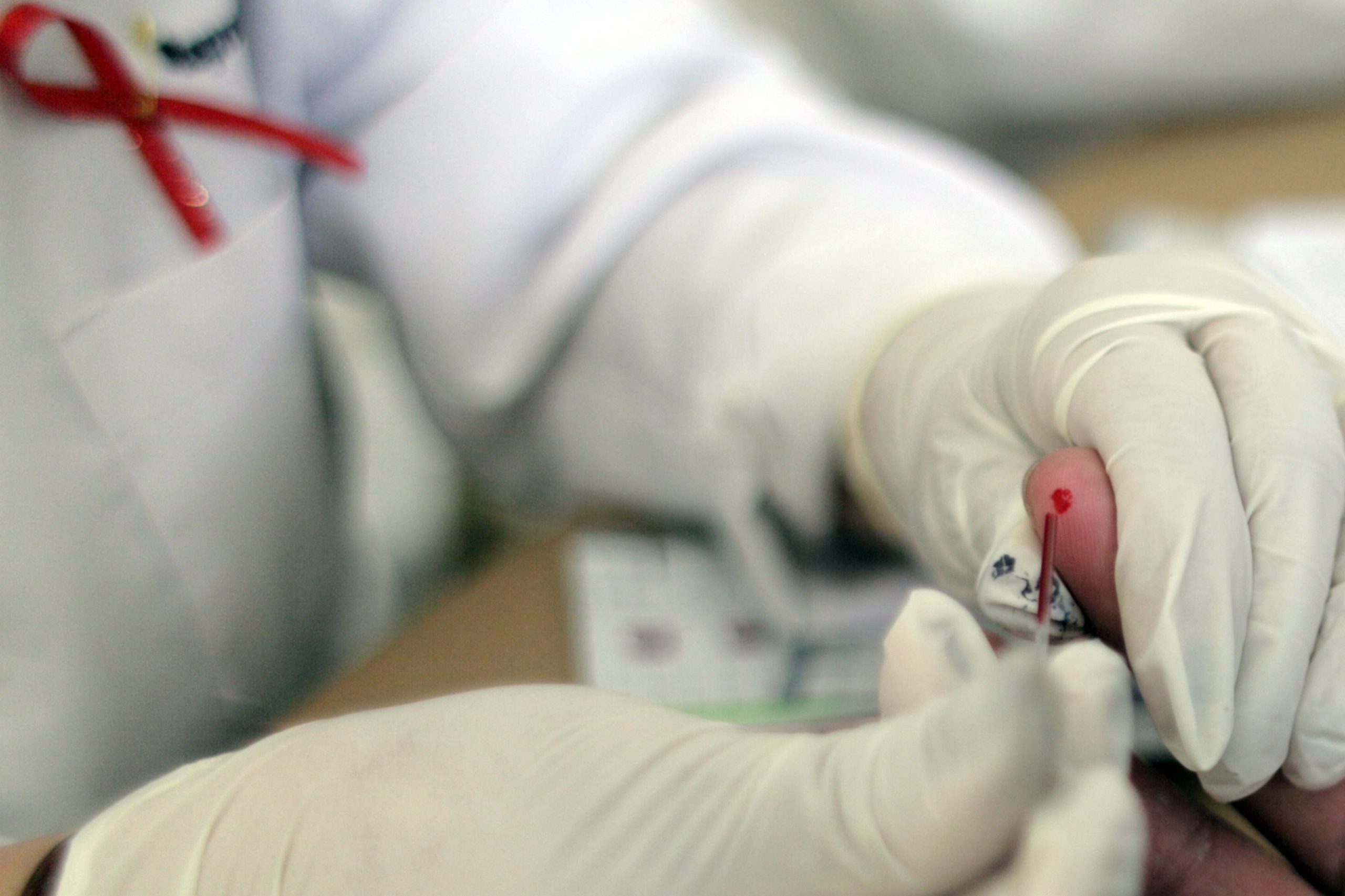 Portugal mantém tendência decrescente em novos casos de infeção por VIH e SIDA