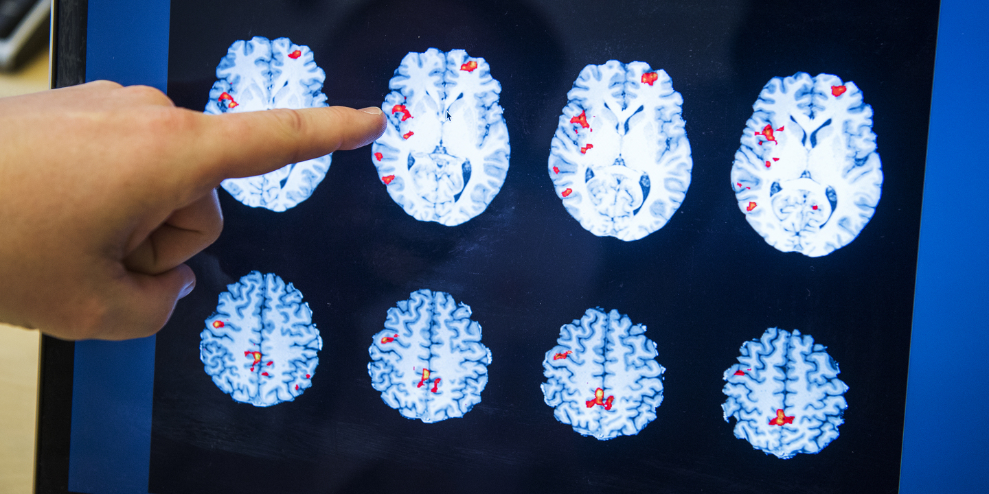 Prémio João Lobo Antunes distingue investigadora que vai testar realidade virtual em doentes de Parkinson