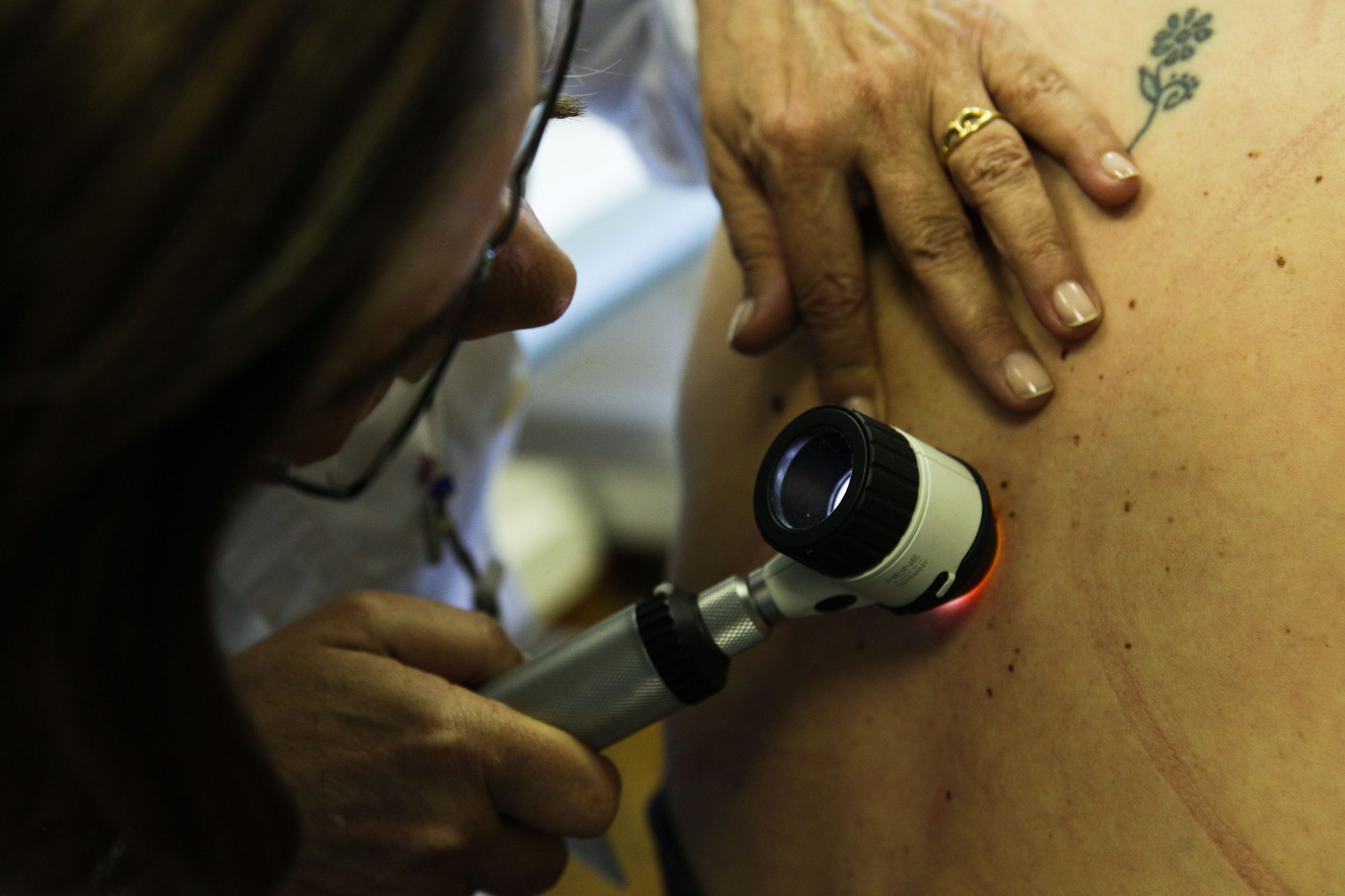 Maioria dos doentes oncológicos nunca ouviu falar de mutações genéticas BRCA