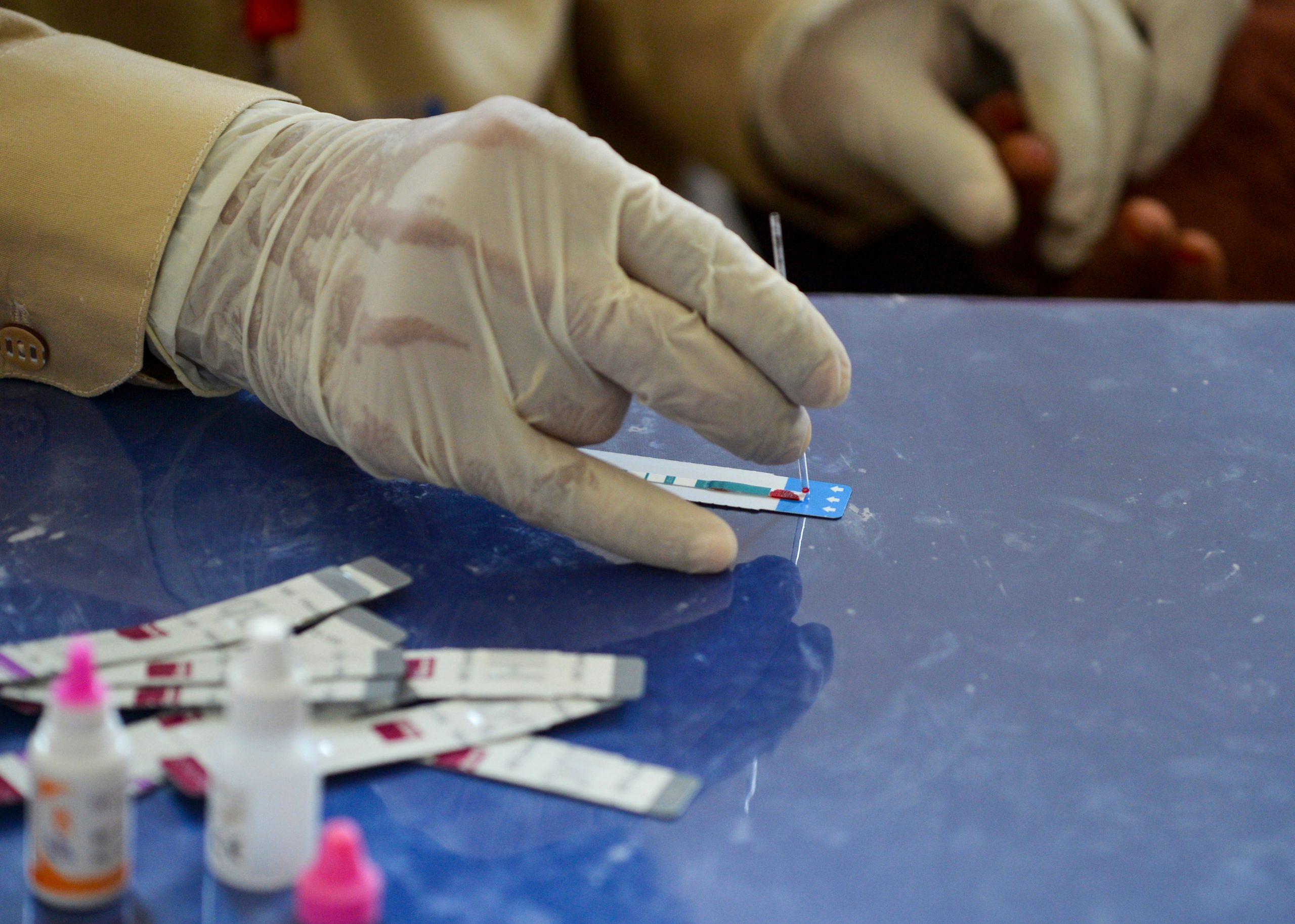 Semana Europeia do Teste VIH-Hepatites começa esta 2ª feira com rastreios gratuitos