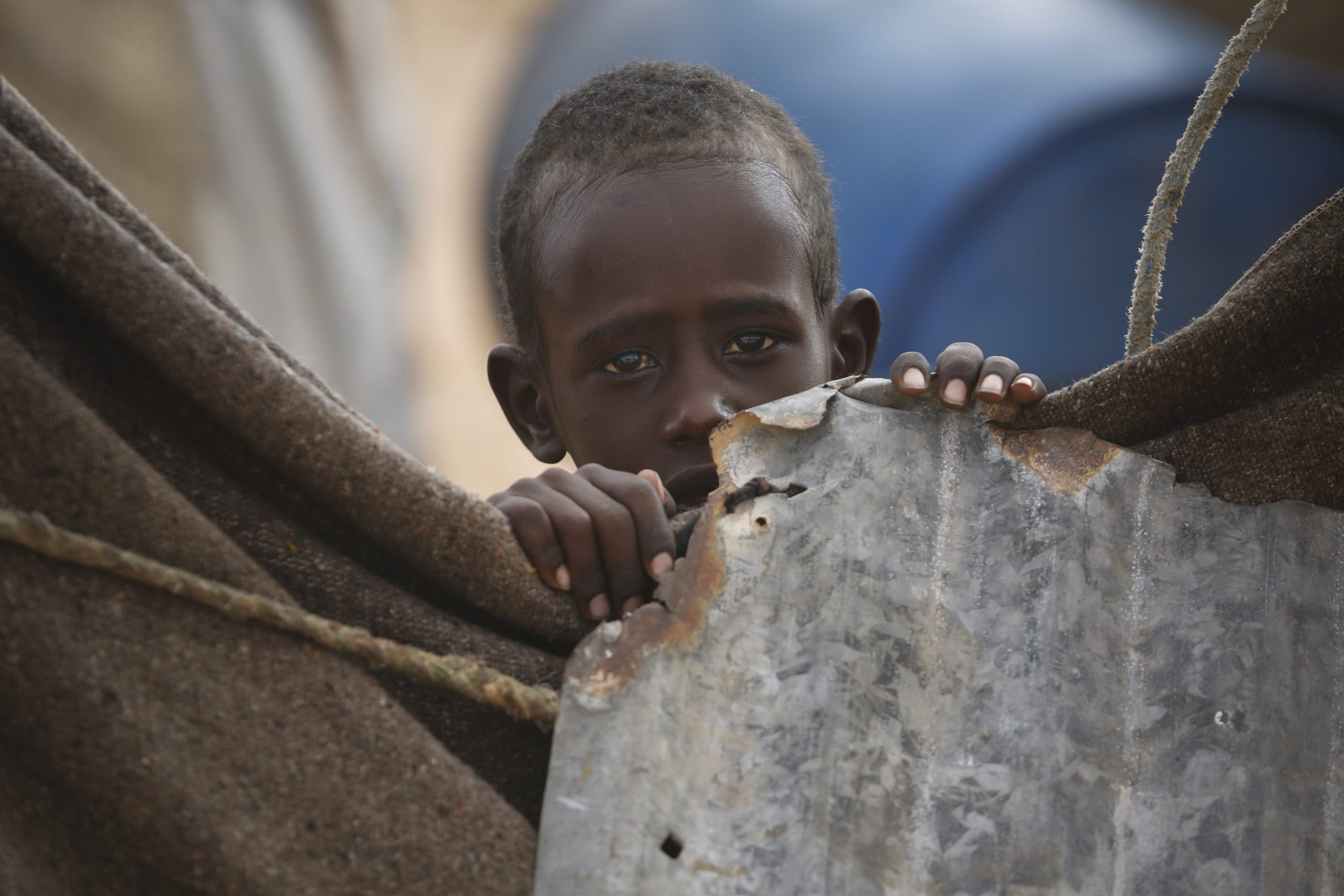 Angola: Malnutrição matou mais de 160 crianças angolanas na província do Bié em 2018