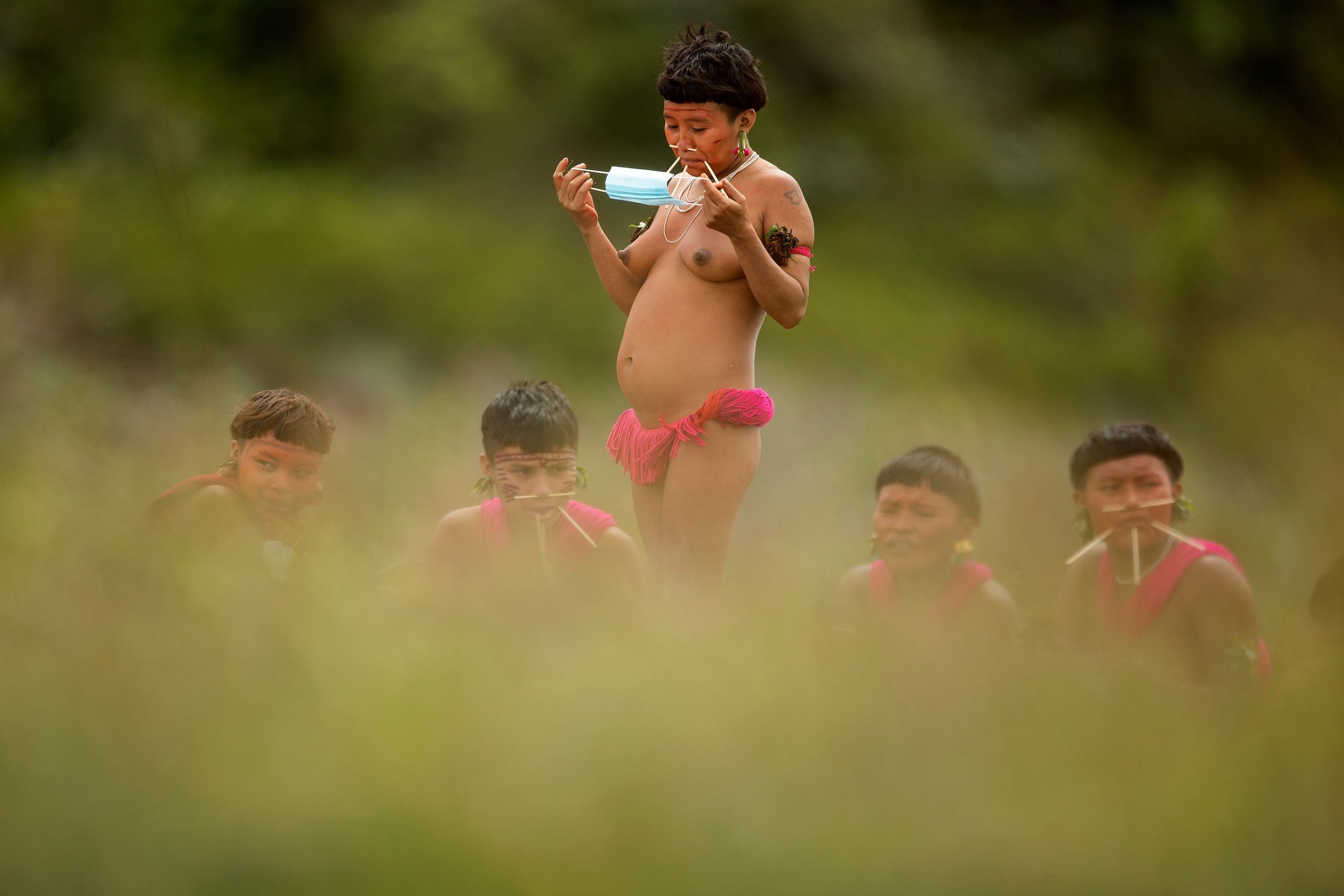 Brasil realizou mais de cinco mil atendimentos médicos ao povo yanomami