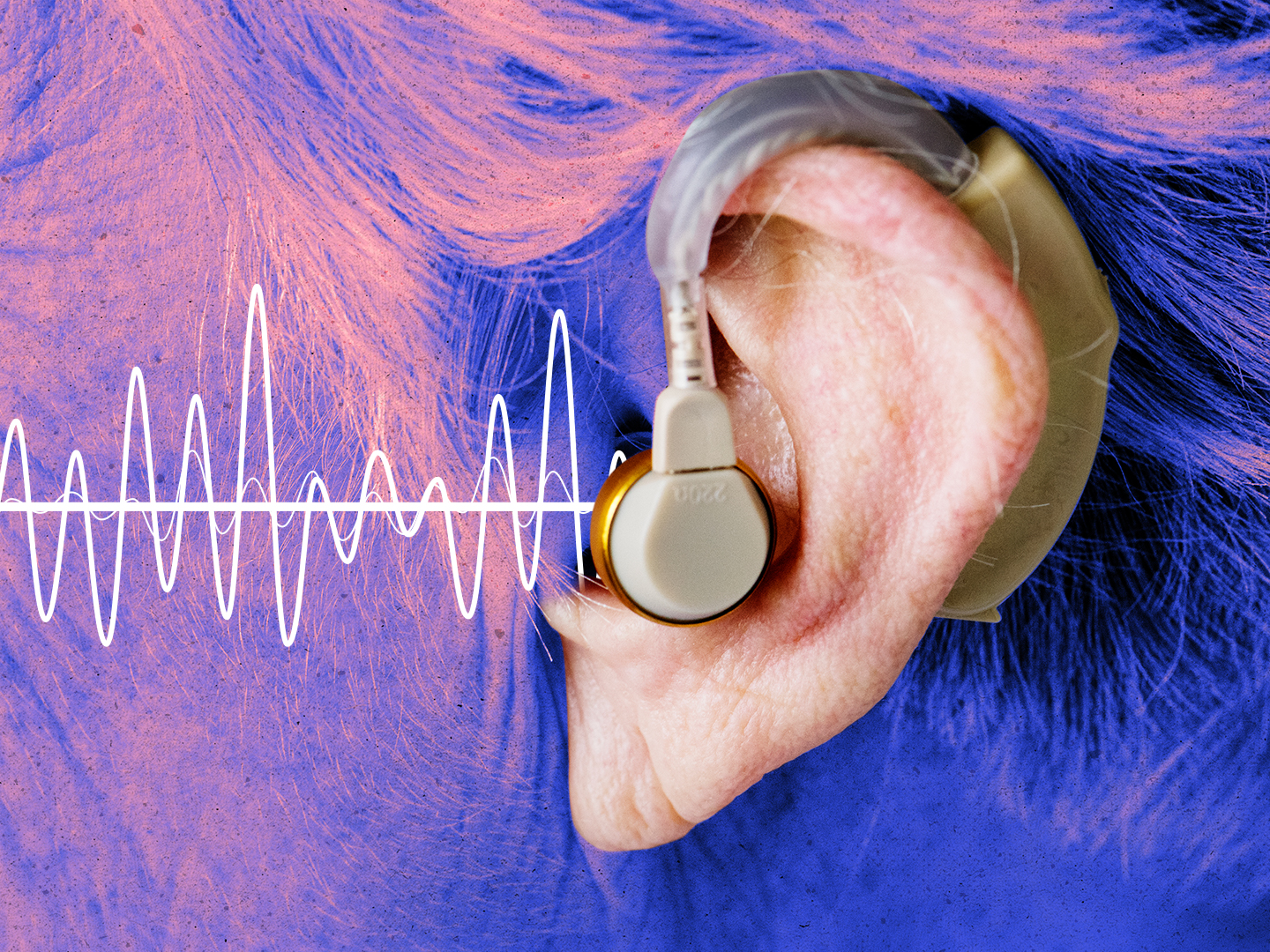 Aparelhos auditivos: entre o dispositivo médico e o amplificador, nem sempre o que parece é