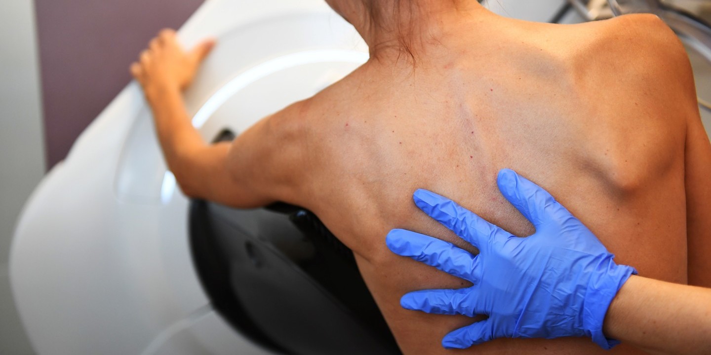 Tenho cancro da mama, posso comer açúcar? Careca power, Amigas do Peito e farmacêutica publicam respostas a 50 perguntas