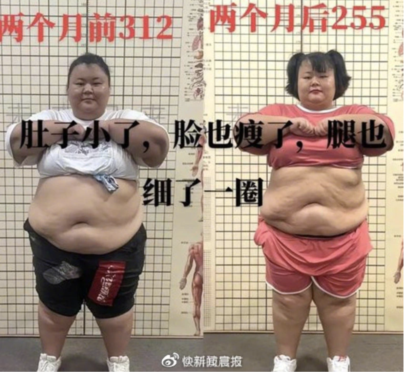 Influencer chinesa morre durante processo de emagrecimento. Seguidores culpam campo de perda de peso