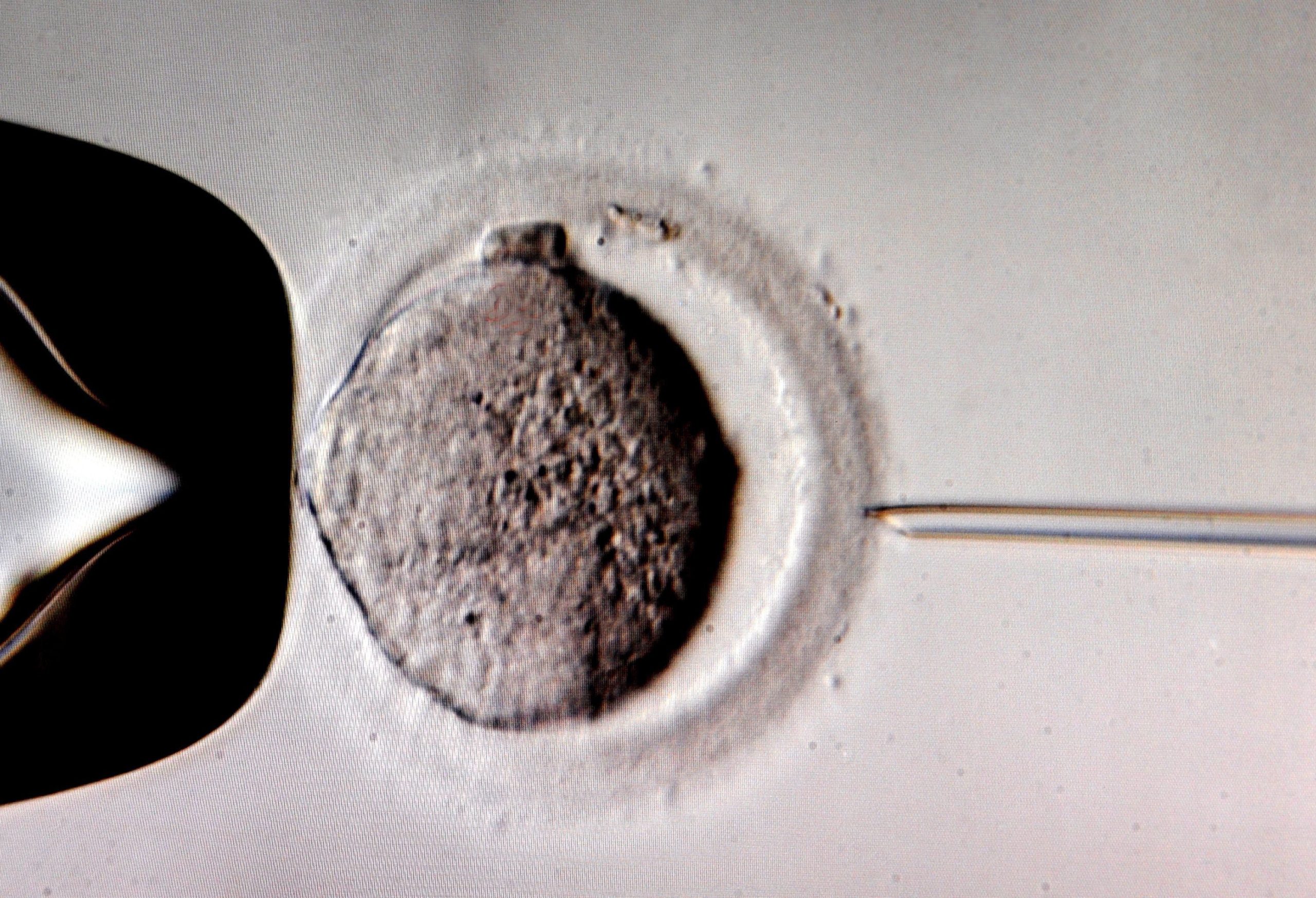 Bebé concebido ‘in vitro’ com ADN de três pessoas diferentes nasceu na Grécia