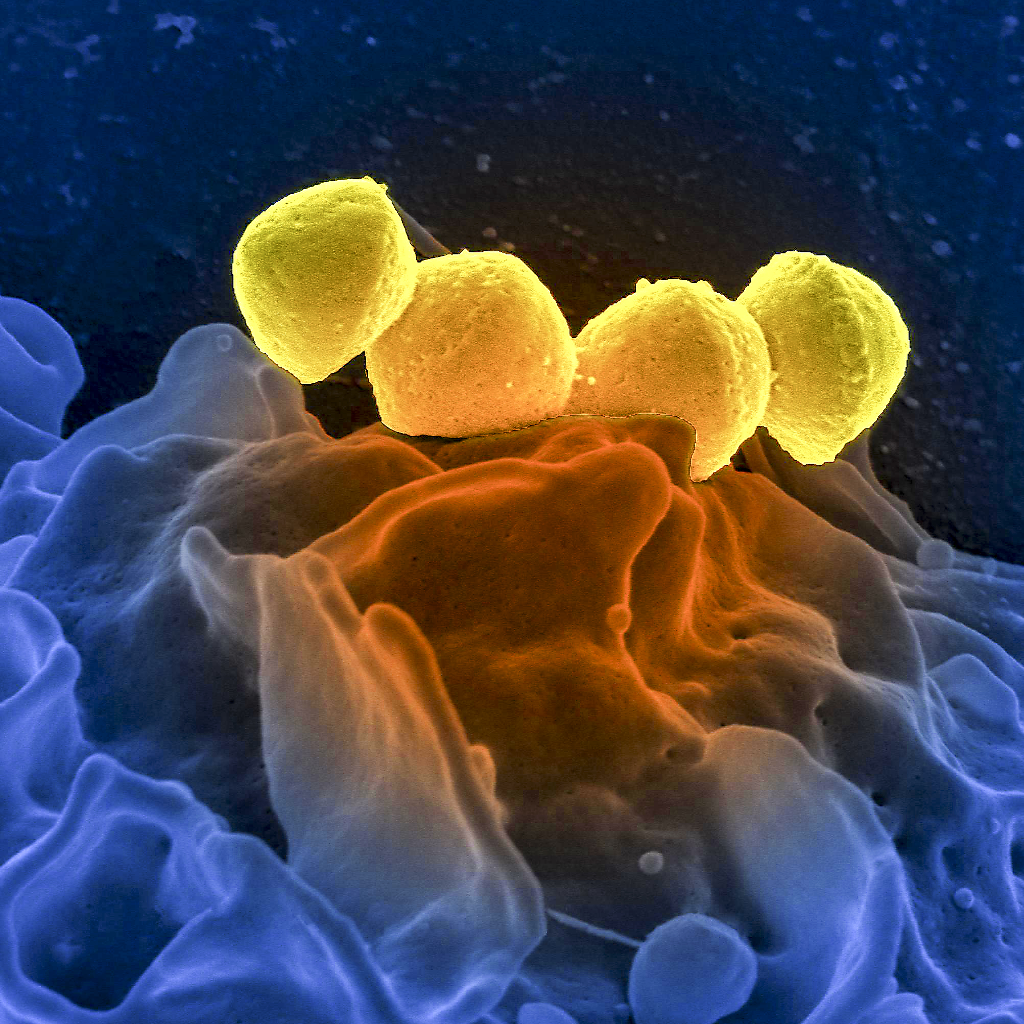 Infeção bacteriana já matou várias crianças na Europa. O que é a Strep A e qual a situação em Portugal?