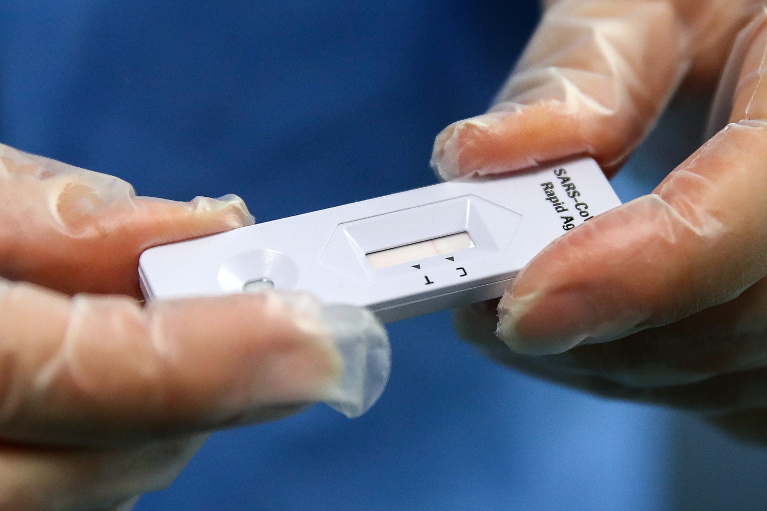 Covid-19: Espanha fixa preço máximo para autotestes