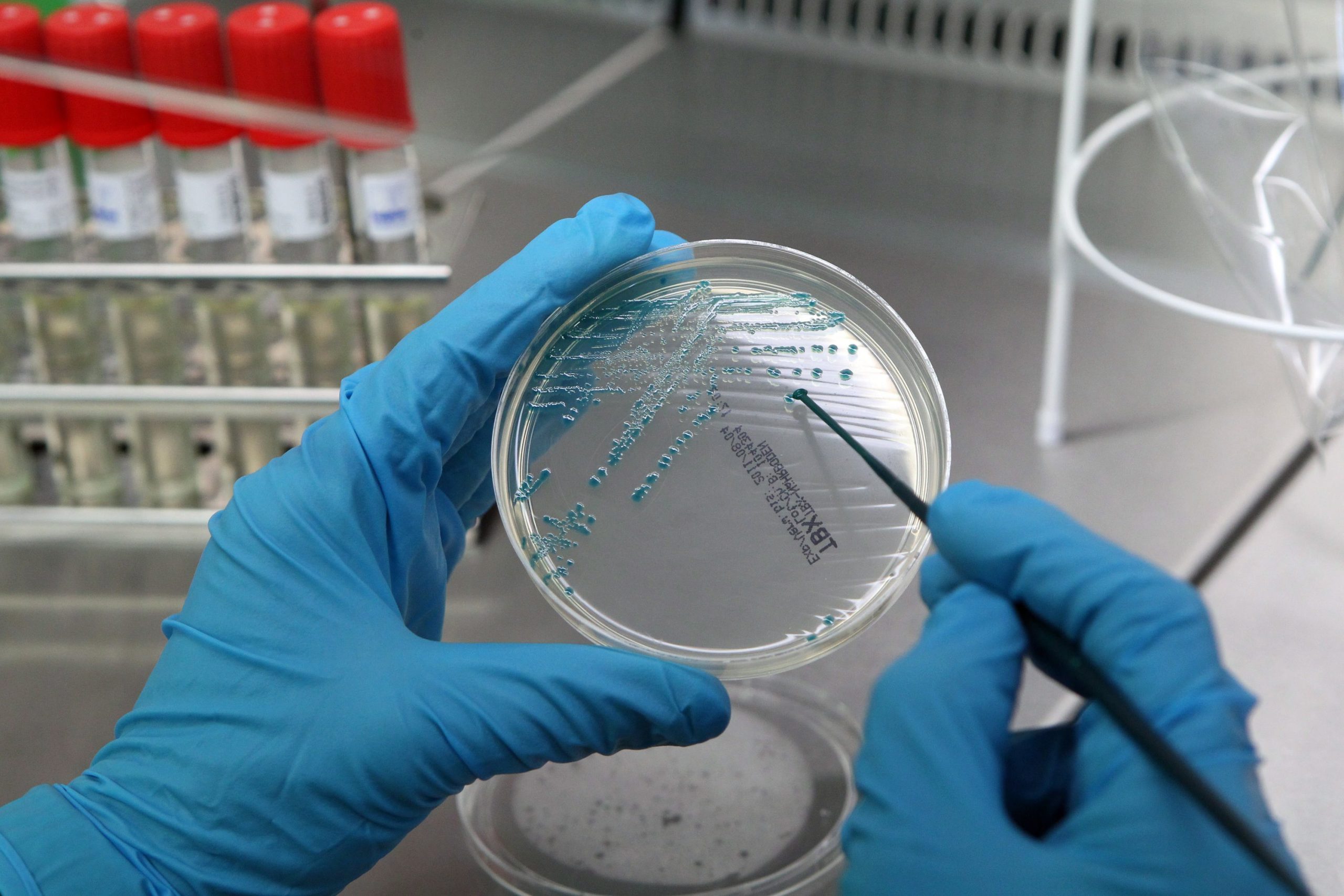Projeto de investigação sobre relação entre doença de Parkinson e diabetes premiado