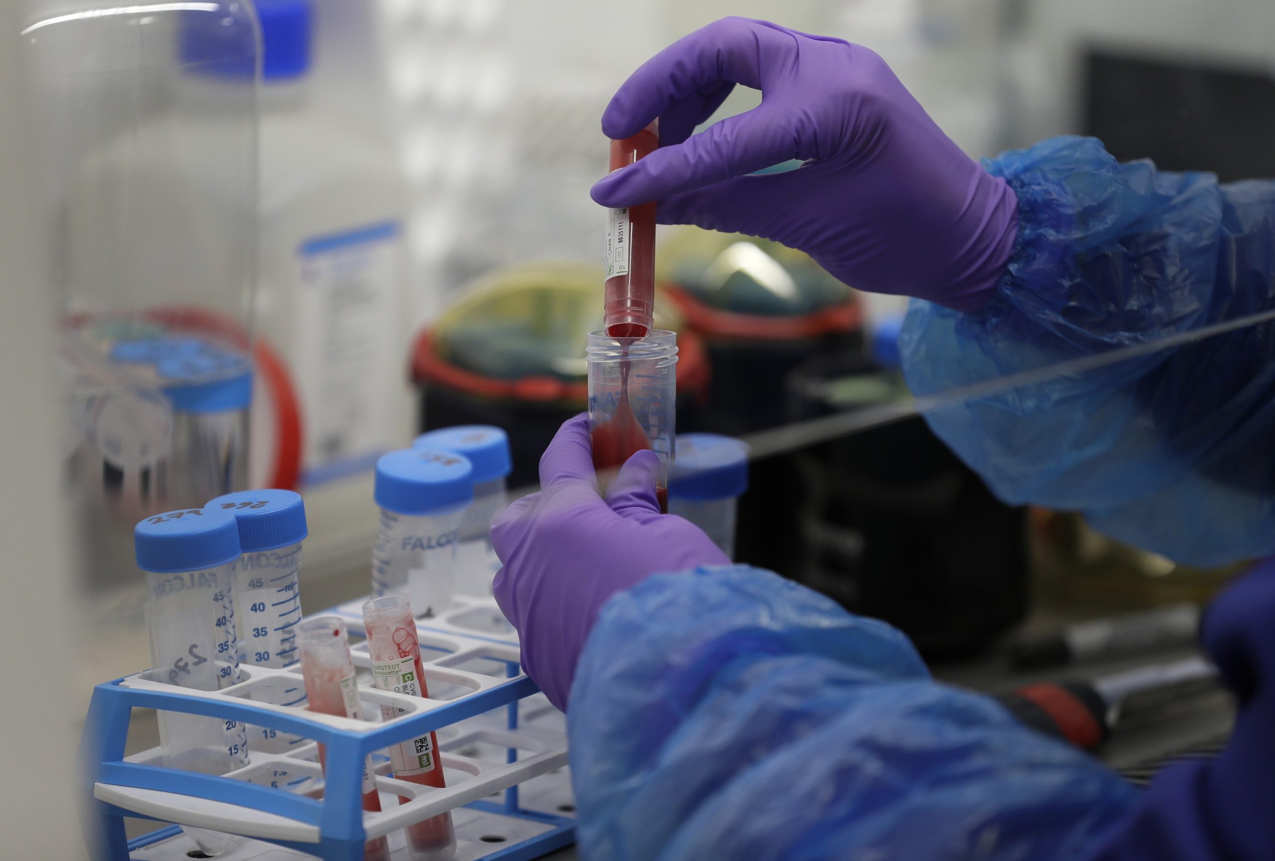 Ensaio clínico britânico conclui que hidroxicloroquina não tem efeitos benéficos